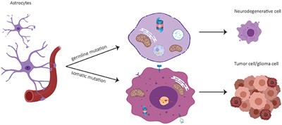 Bidirectional Relation Between Parkinson's Disease and Glioblastoma Multiforme